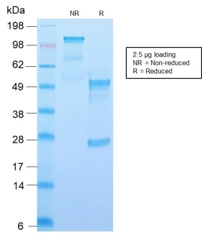Anti-CD34 (Hematopoietic Stem Cell & Endothelial Marker) (HPCA1/2598R) - image 6