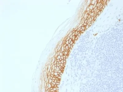 Anti-CD44v9 (Marker of Tumor Metastasis) (CD44v9/2344R) - image 1