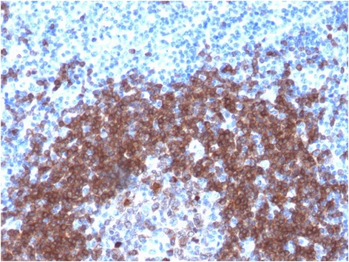 Anti-CD79a (B-Cell Marker) (IGA/1790R) - image 1