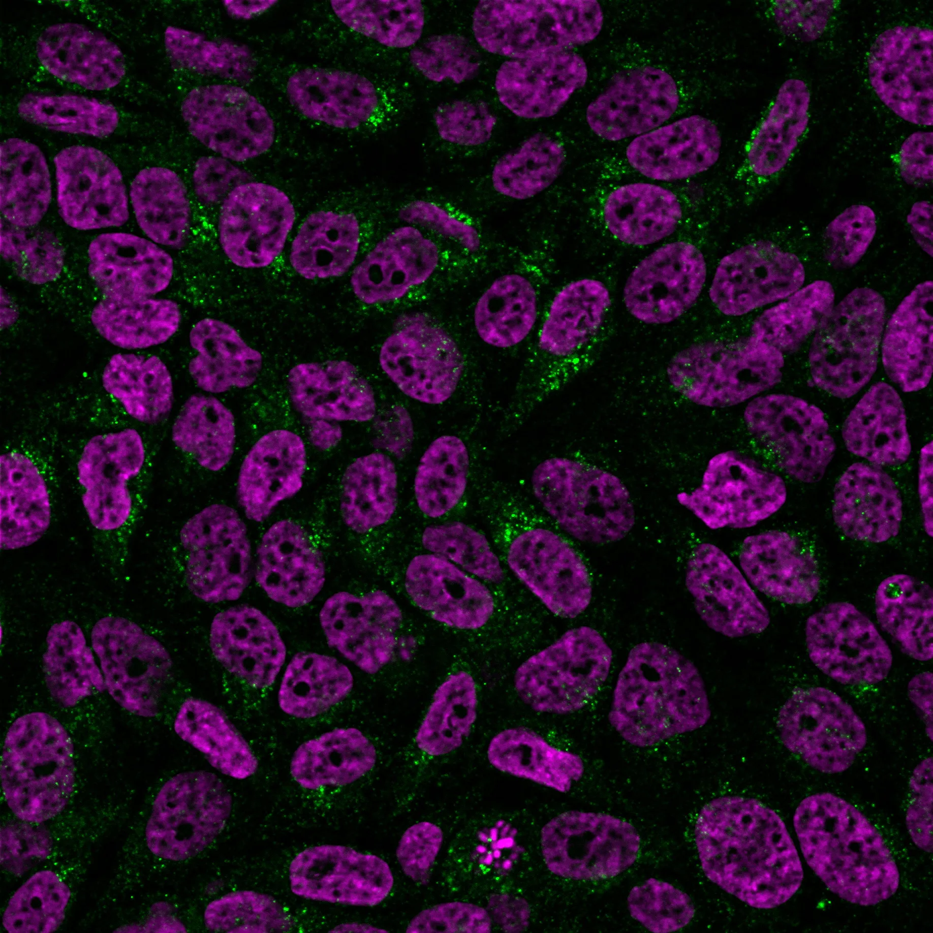 Anti-Golgi Complex (Marker for Human Cells) (GLG1/2829R) - image 3