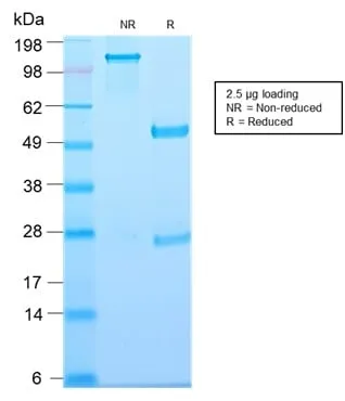 Anti-Thymidine Phosphorylase / PD-ECGF (Angiogenesis Marker) (TYMP/2890R) - image 2