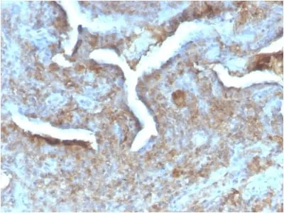 Anti-Thymidine Phosphorylase / PD-ECGF (Angiogenesis Marker) (TYMP/2890R) - image 1
