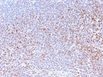 Anti-Nuclear Antigen (Pan-Nuclear Marker) (NM2984R) - image 2