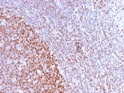 Anti-Nuclear Antigen (Pan-Nuclear Marker) (NM2984R) - image 1