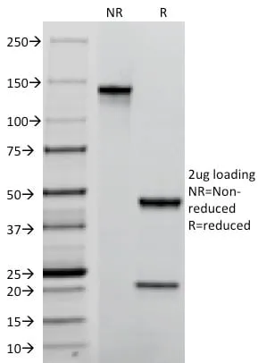 Anti-TACSTD2 / TROP2 (Epithelial Marker) (TACSTD2/2152) - image 4
