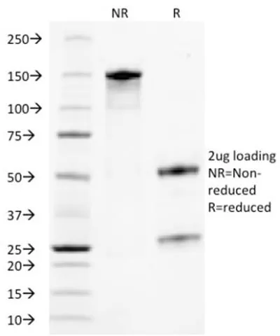 Anti-TACSTD2 / TROP2 (Epithelial Marker) (TACSTD2/2153) - image 5