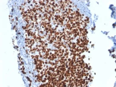 Anti-Ki-67 (Proliferating Cell Marker) (MKI67/2462) - image 2