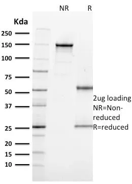 Anti-Ki-67 (Proliferating Cell Marker) (MKI67/2462) - image 4