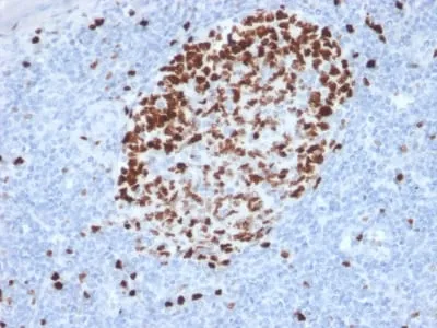 Anti-Ki-67 (Proliferating Cell Marker) (MKI67/2462) - image 5
