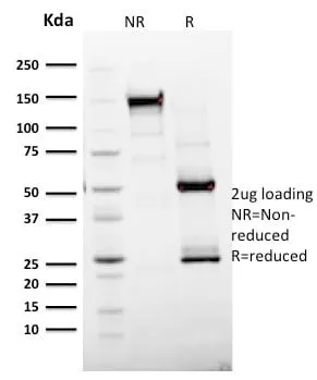 Anti-Ki-67 (Proliferating Cell Marker) (MKI67/2465) - image 2