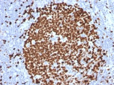 Anti-Ki-67 (Proliferating Cell Marker) (MKI67/2465) - image 3