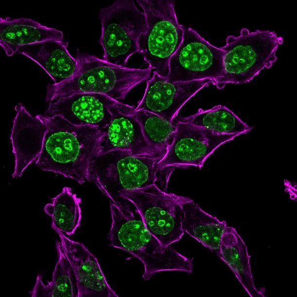 Anti-Ki-67 (Proliferating Cell Marker) (MKI67/2465) - image 1