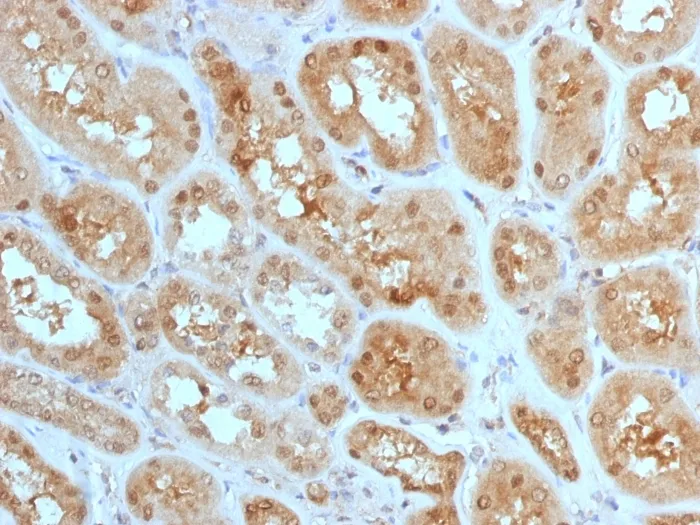 Anti-MTAP (Tumor Suppressor Marker) (MTAP/1813) - image 1