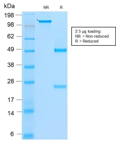 Anti-MyoD1 (Rhabdomyosarcoma Marker) (rMYD712) - image 2