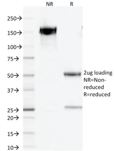 Anti-PAX5 / BSAP (Early B-Cell Marker) (PCRP-PAX5-1B7) - image 4
