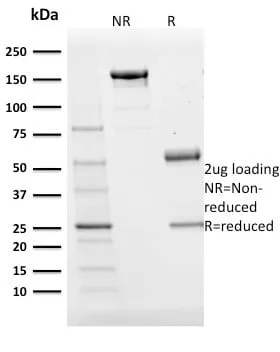 Anti-BOB.1 (B-Cell Marker) (BOB1/2424) - image 3
