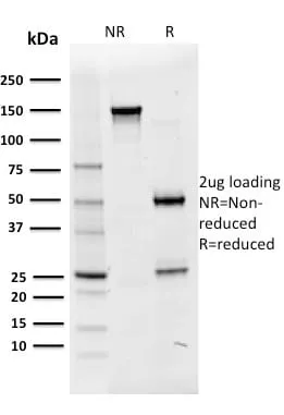 Anti-OCT-2 (POU2F2) (B-Cell Marker) (OCT2/2136) - image 3