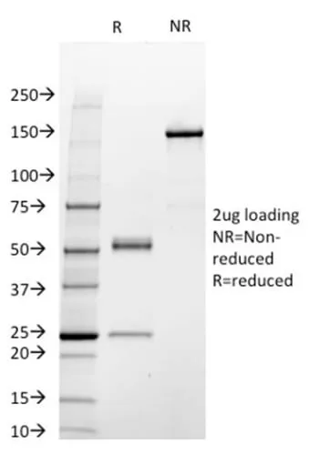 Anti-STAT3 / Signal Transducer and Activator of Transcription 3 (STAT3/2409) - image 2