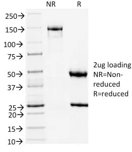 Anti-TLE1 (Synovial Sarcoma Marker) (TLE1/2051) - image 2