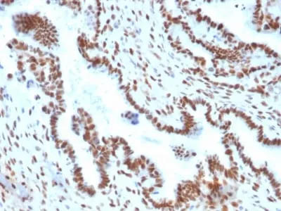 Anti-TLE1 (Synovial Sarcoma Marker) (TLE1/2051) - image 1