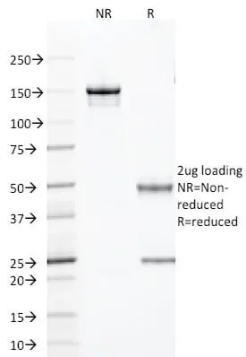 Anti-TLE1 (Synovial Sarcoma Marker) (TLE1/2085) - image 2