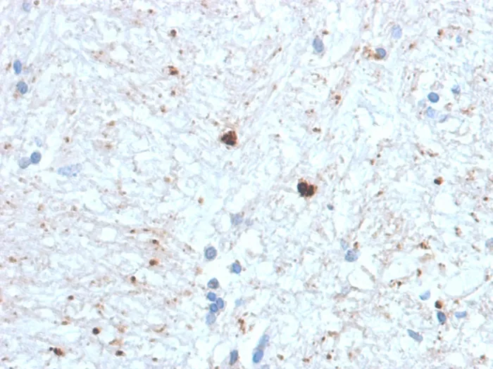 Anti-Ubiquitin (Autophagy Marker) (UBB/1748) - image 1