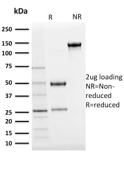 Anti-Ubiquitin (Autophagy Marker) (UBB/2122) - image 3