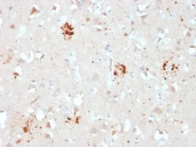 Anti-Ubiquitin (Autophagy Marker) (UBB/2122) - image 1