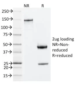Anti-ZAP70 (Chronic Lymphocytic Leukemia Marker) (ZAP70/2035) - image 2