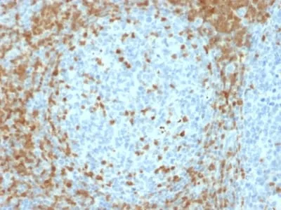 Anti-ZAP70 (Chronic Lymphocytic Leukemia Marker) (ZAP70/2035) - image 1