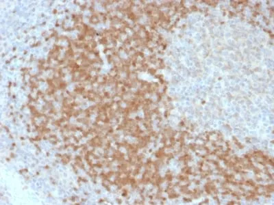 Anti-TCL1 (T-Cell Marker) (TCL1/2078) - image 2