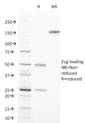 Anti-TCL1 (T-Cell Marker) (TCL1/2078) - image 3
