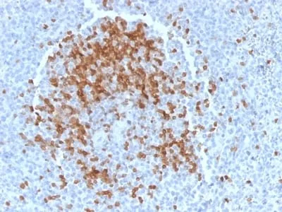 Anti-TCL1 (T-Cell Marker) (TCL1/2078) - image 1