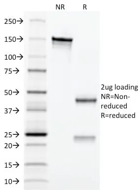 Anti-CD3e (T-Cell Marker) (C3e/2479) - image 2
