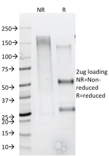 Anti-CD79b (B-Cell Marker) (IGB/1844) - image 1