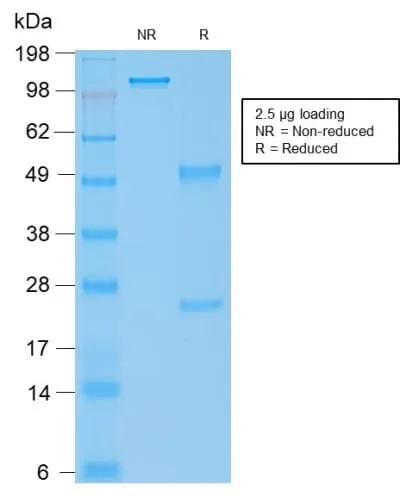 Anti-Human IgG4 (Ig Heavy Constant Gamma 4) (G4m Marker) (rIGHG4/1345) - image 2