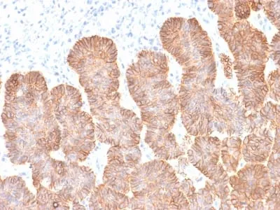 Anti-Ep-CAM / CD326 (Extracellular Domain) (Epithelial Marker) (rEGP40/1372) - image 2