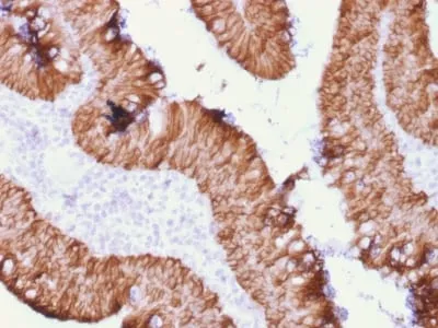 Anti-Ep-CAM / CD326 (Extracellular Domain) (Epithelial Marker) (rEGP40/1372) - image 1