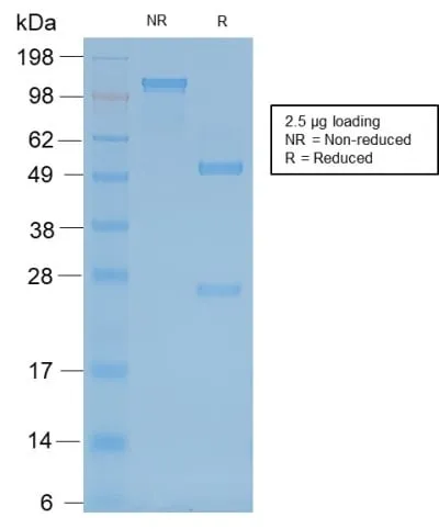 Anti-Neurofilament (NF-H) (Neuronal Marker) (rNF421) - image 2