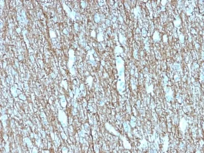 Anti-Neurofilament (NF-H) (Neuronal Marker) (rNF421) - image 1