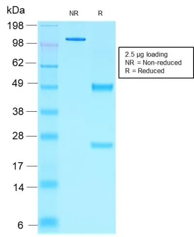 Anti-NKX2.2 (Neuroendocrine & Ewing s Sarcoma Marker) (rNX2/1523) - image 2