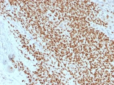 Anti-NKX2.2 (Neuroendocrine & Ewing s Sarcoma Marker) (rNX2/1523) - image 1
