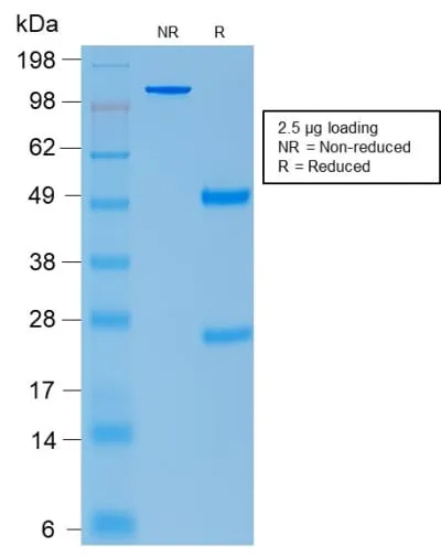 Anti-ACTH (Adrenocorticotrophic Hormone) (Pituitary Marker) (rCLIP/1407) - image 1