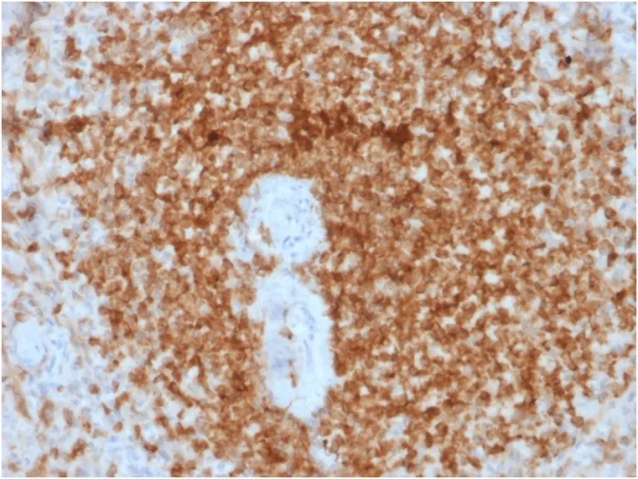 Anti-Bcl-2 (Apoptosis & Follicular Lymphoma Marker) (rBCL2/796) - image 1