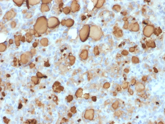 Anti-Thyroglobulin (Thyroidal Cell Marker) (rTGB24) - image 1