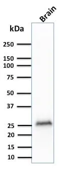 Anti-PGP9.5 / UchL1 (pan-Neuronal Marker) (rUCHL1/775) - image 3