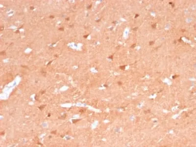 Anti-PGP9.5 / UchL1 (pan-Neuronal Marker) (rUCHL1/775) - image 1