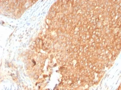 Anti-Topoisomerase I, Mitochondrial (TOP1MT) (TOP1MT/2883R) - image 1