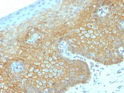 Anti-Catenin, beta (CTNNB1) (CTNNB1/2030R) - image 2