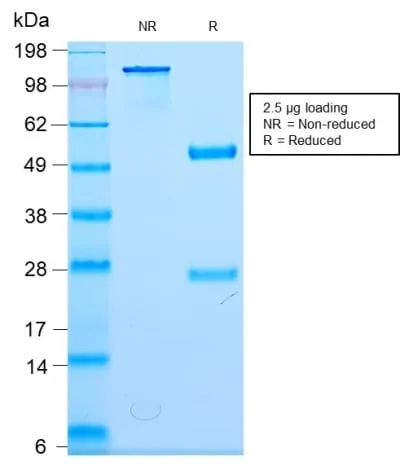 Anti-Neurofilament (NF-L) (Neuronal Marker) (NEFL/2983R) - image 2